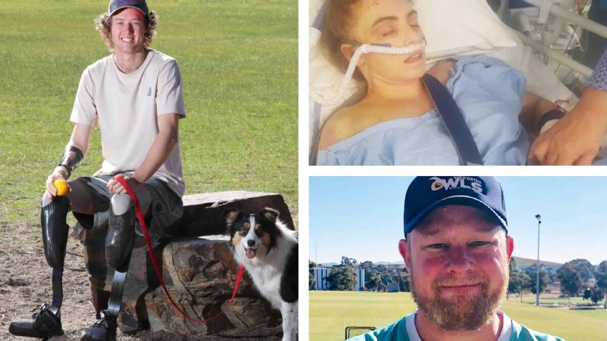 COURAGE PERSONIFIED: Josh Hanlon with Lulu (left); Elise Woodcock after her life-changing crash and ACT rugby union coach Dave Oliver.