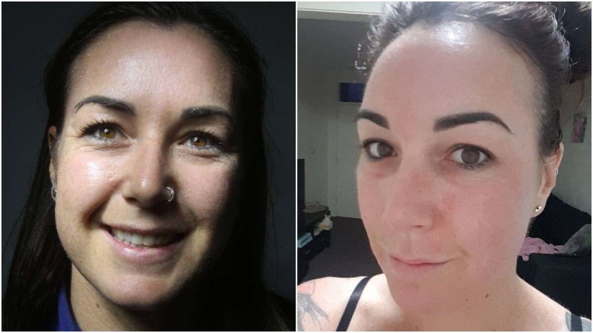 BEFORE AND AFTER: Mercury reader Chloe Drabsch before getting the vampire facial and the day after. Pictures: Robert Peet and Supplied